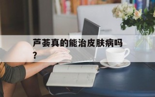 芦荟真的能治皮肤病吗？