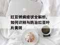 豇豆锈病症状全解析,如何识别与防治豇豆叶片黄斑
