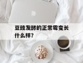 豆豉发酵的正常霉变长什么样？